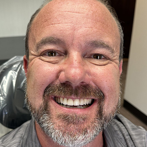 Protect Your Dental Health With General Dentistry in Edmonds